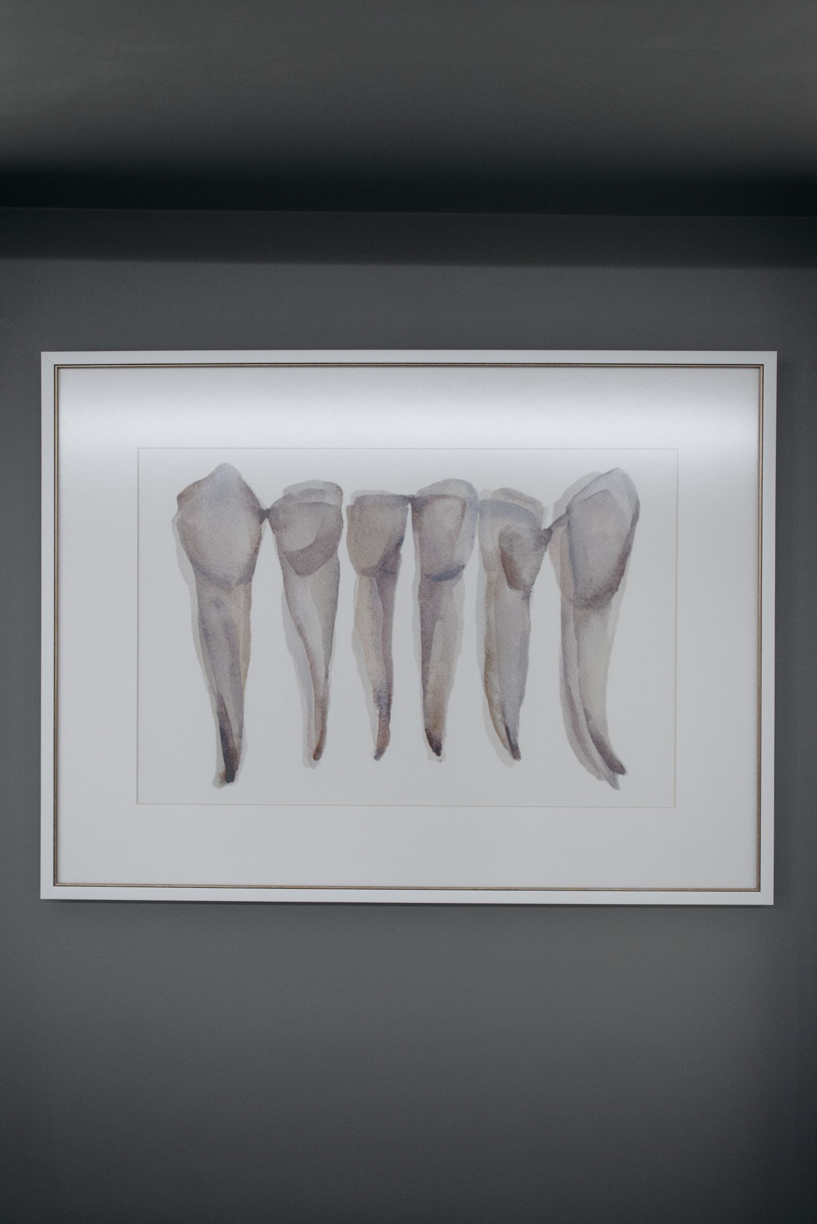 Anatomical tooth models used to explain treatment